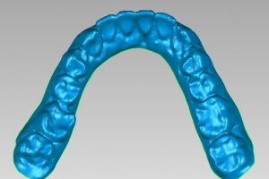 精确曲面与参数化曲面-牙齿逆向建模